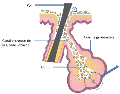 GLANDES SEBACEES ET SEBUM